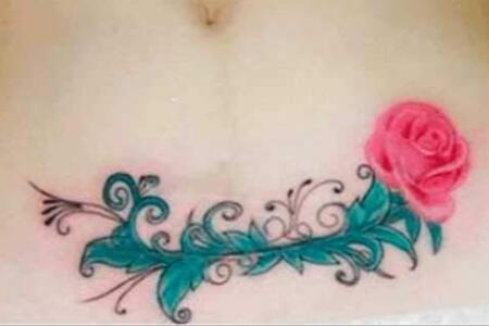 好看的剖腹产纹身图案，让生命的伤疤绽放美丽的花朵
