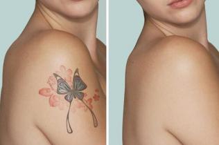 洗纹身后的样子好看吗，四种主流洗纹身方法效果图